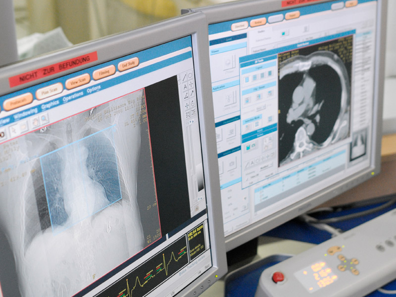 stock-photo-computer-tomography-20995790